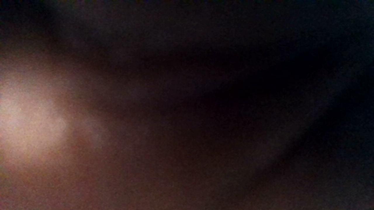 How was your post operative experience?