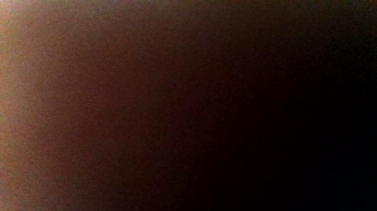 How was your post operative experience?