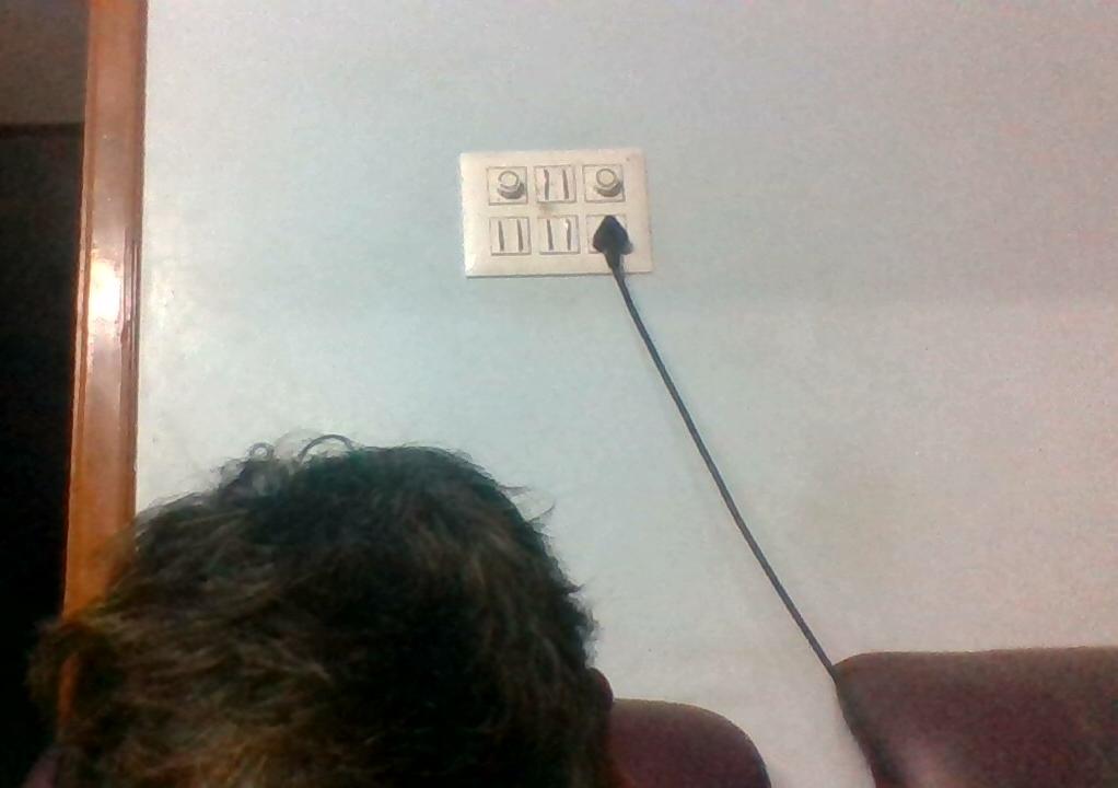 How was your post operative experience?