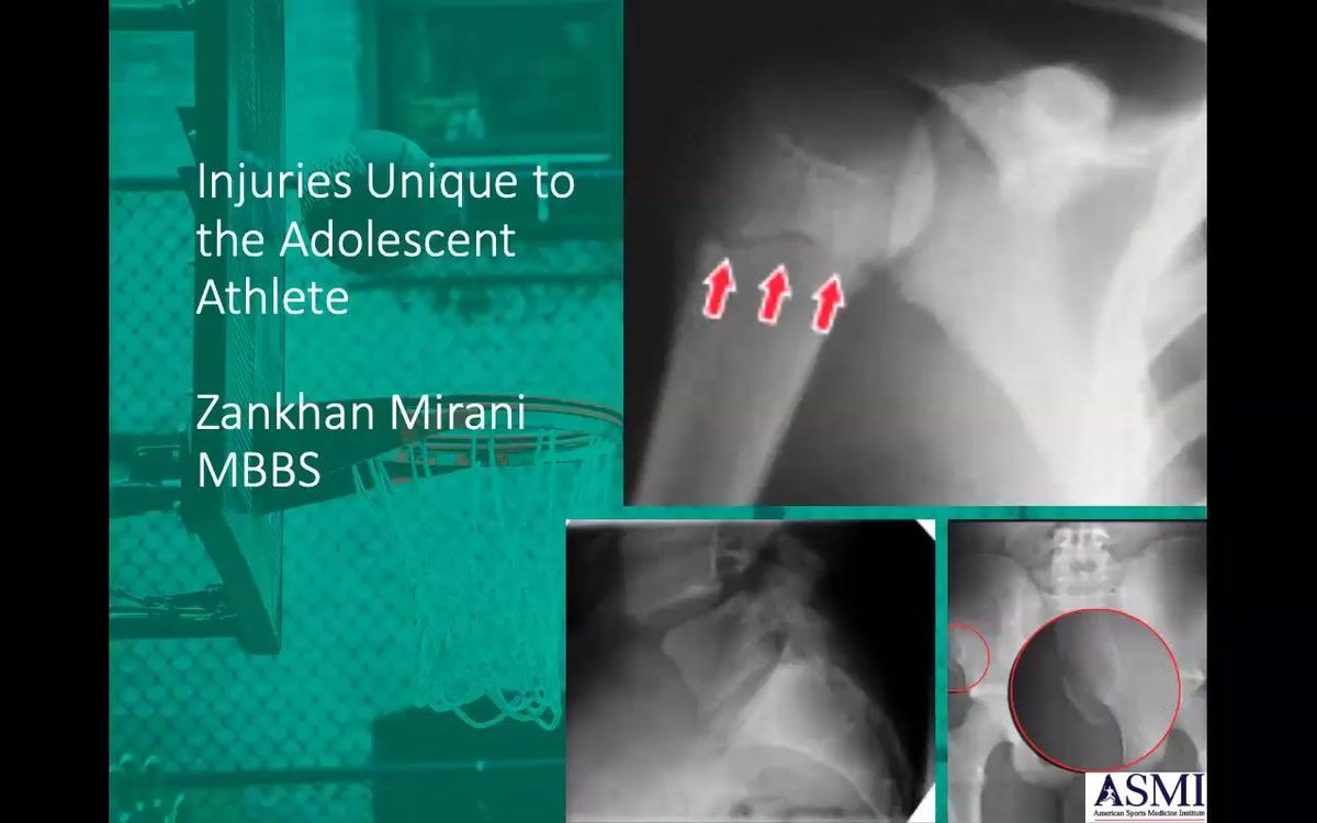 Injuries Unique to the Adolescent Athlete