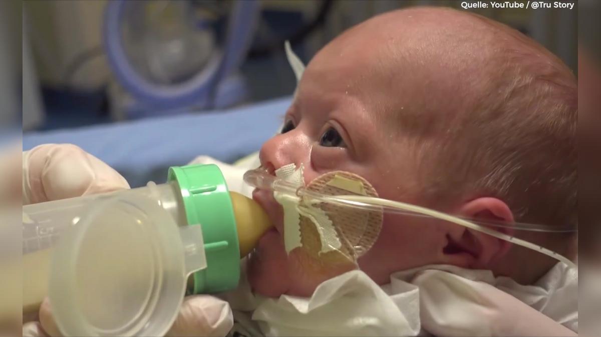 Baby kommt 14 Wochen zu früh auf die Welt - So sieht sie heute aus