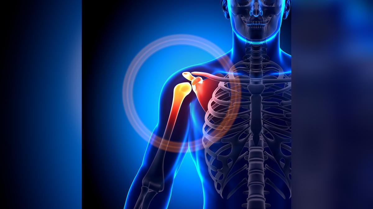 An Overdue Paradigm Shift for Subacromial Shoulder Pain