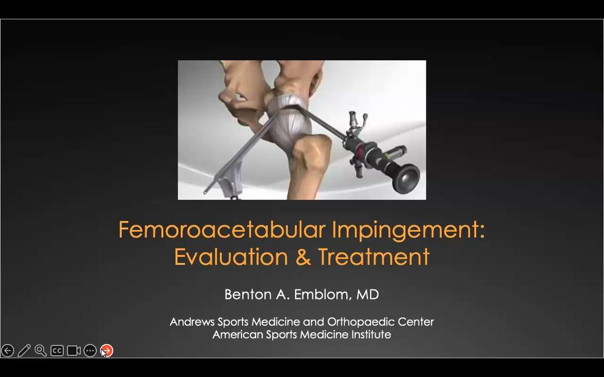 Femoroacetabular Impingement