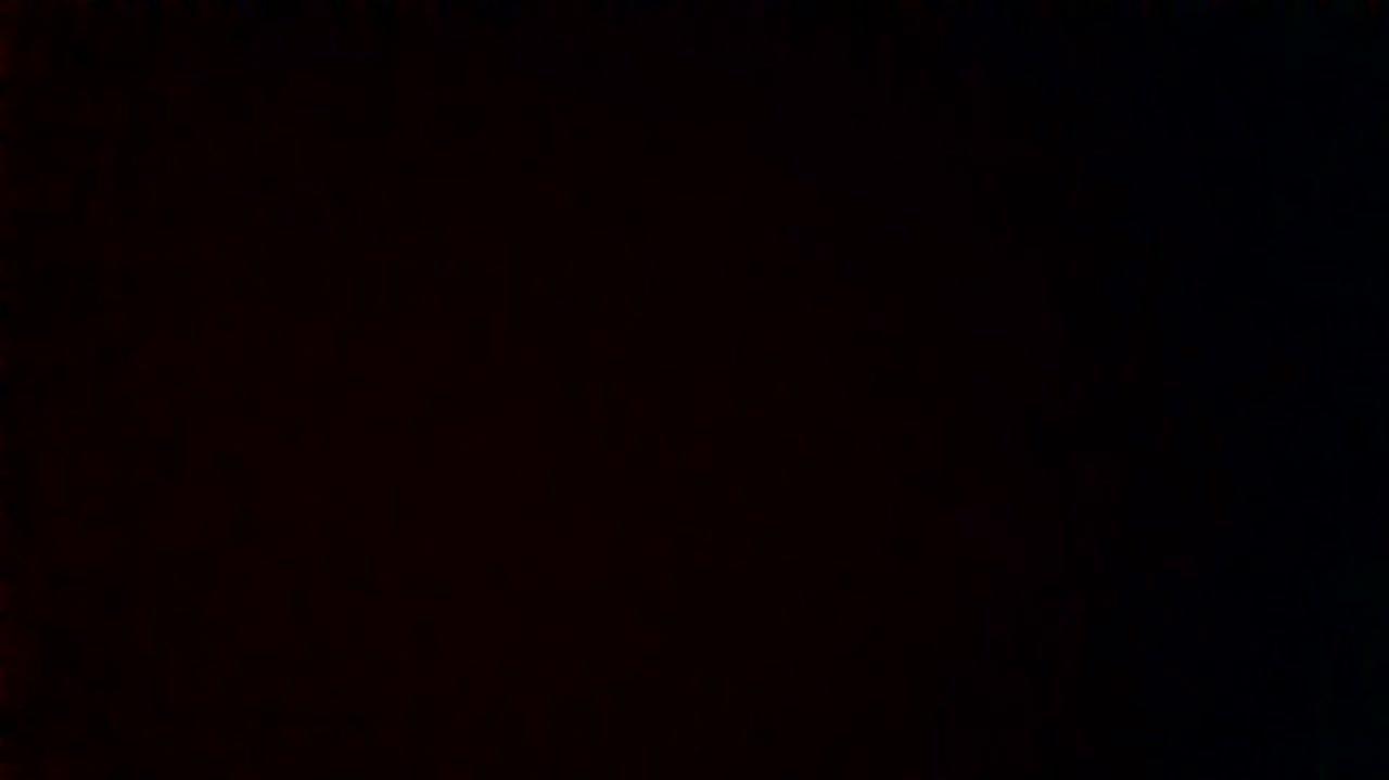 How was your post operative experience?