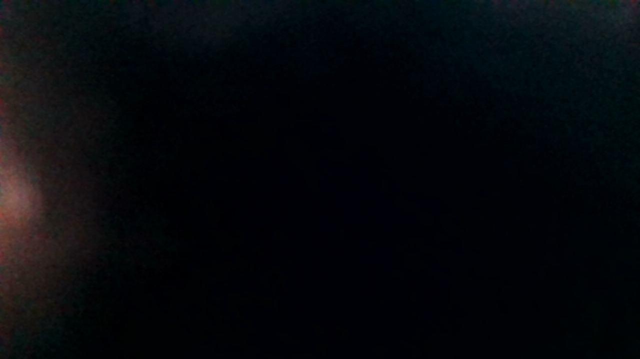 How was your post operative experience?