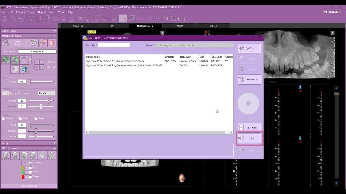 iRYS 11 - Burning a Viewer Disk