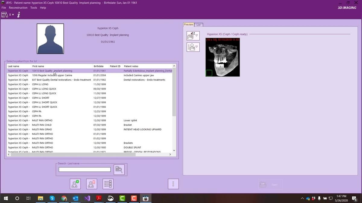 iRYS 11 - Opening Patient Data