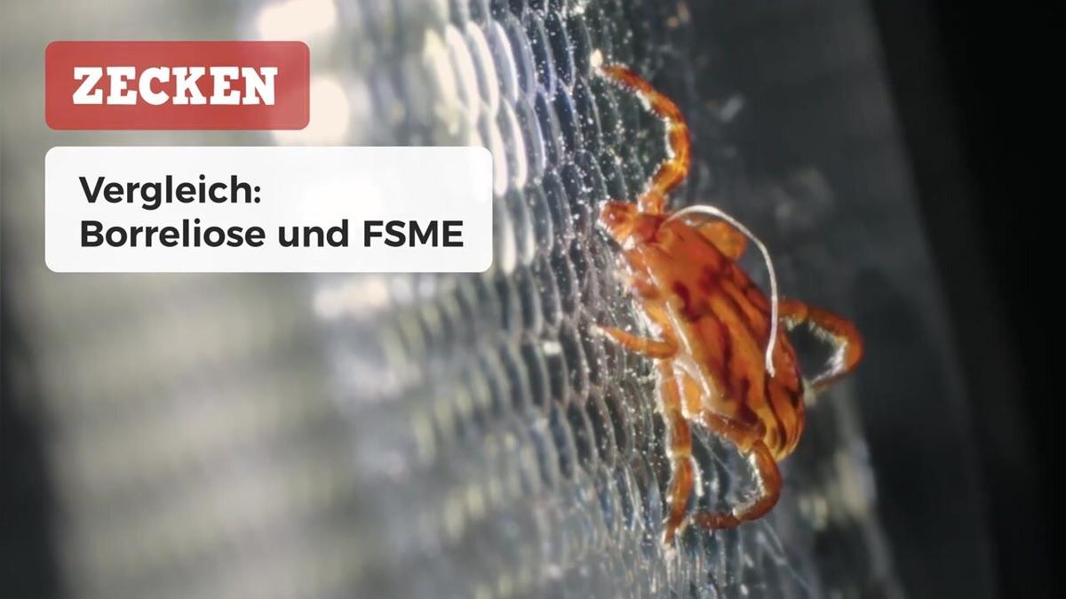 Borreliose und FSME im Vergleich