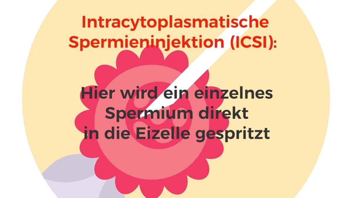 Künstliche Befruchtung