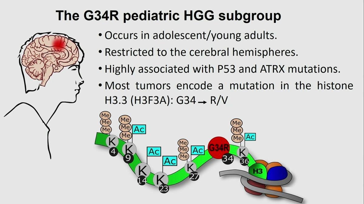 Elucidating molecular pathogenic mechanisms of the histone H3.3 G34R mutation in pediatric high-grade gliomas, Santiago Haase