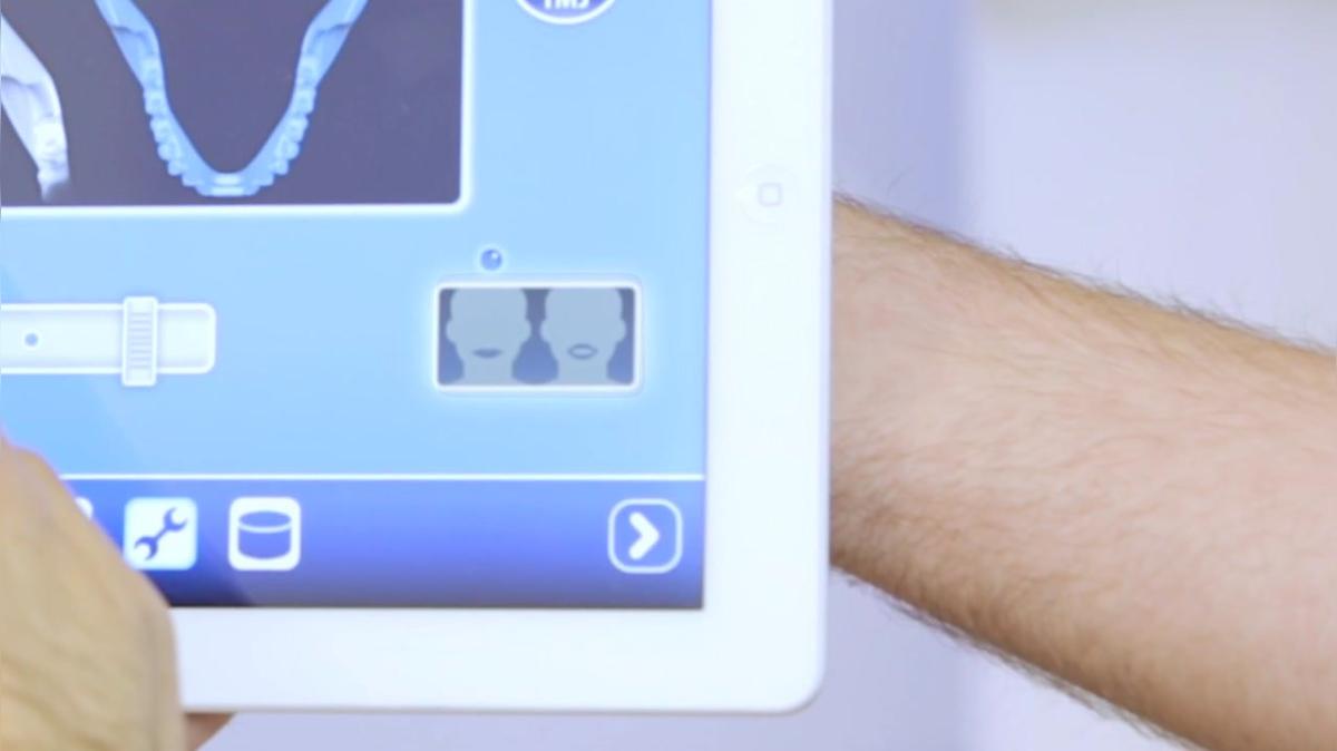 NewTom GO TMJ Positioning