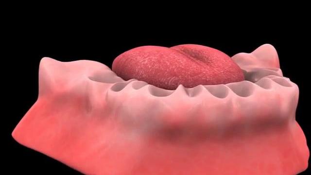 Mandible_Crown_and_Bridge_Reconstruction.mp4