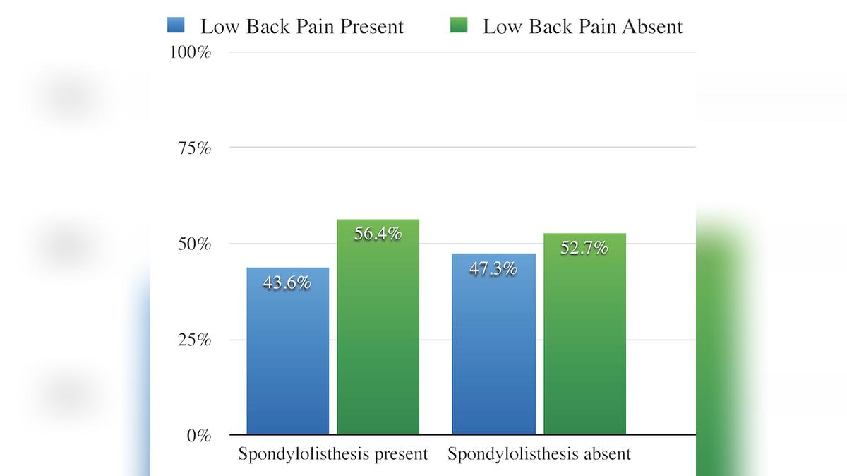 Surgery Unnecessary for Spondylolisthesis