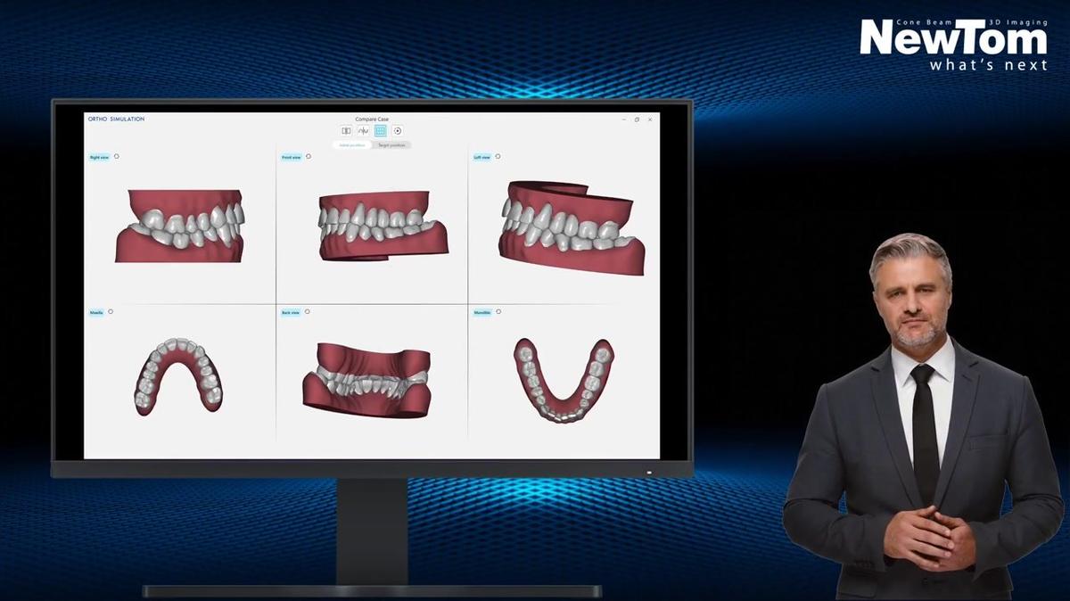 Ortho Simulation