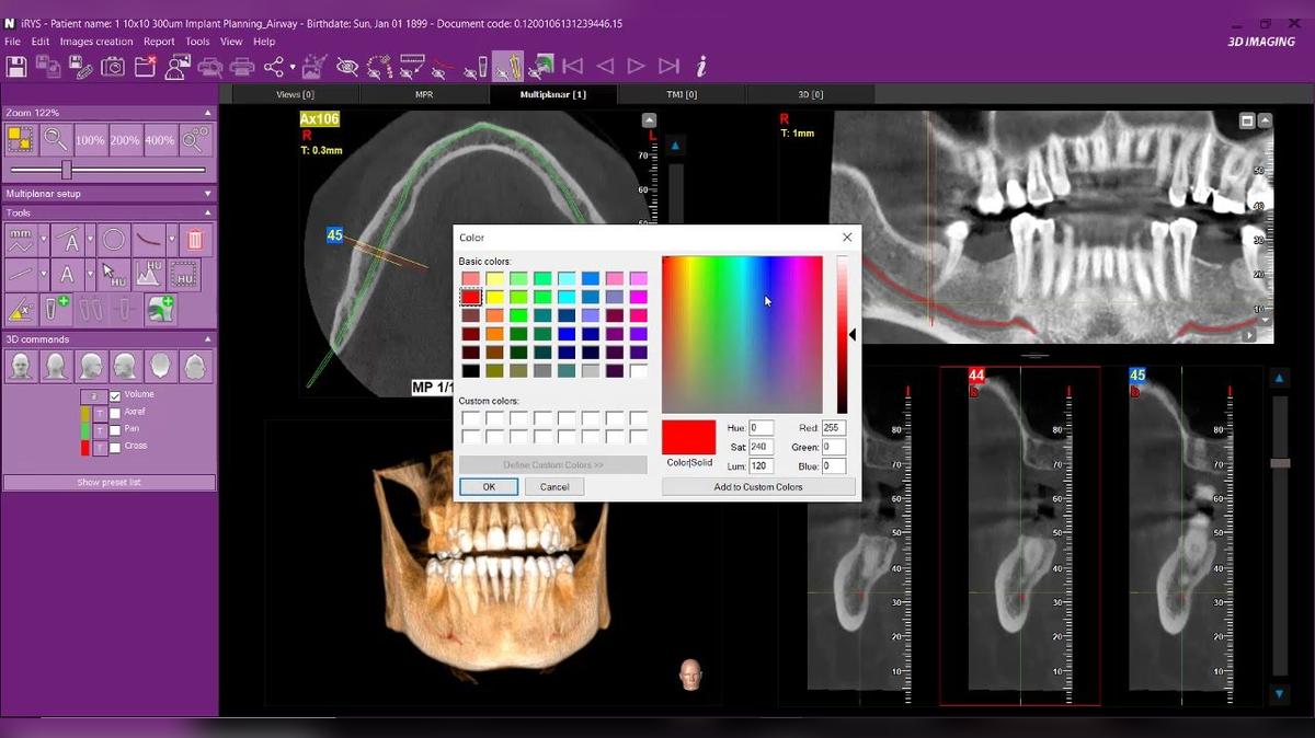 iRYS 11 - Marker Tool