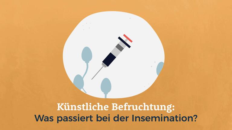 Künstliche Befruchtung: Was passiert bei der Insemination