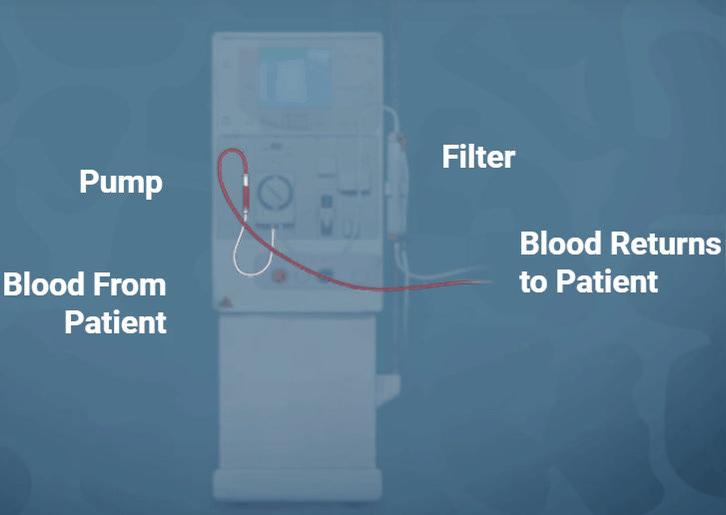 Homeostasis Gizmo - Dialysis Filter