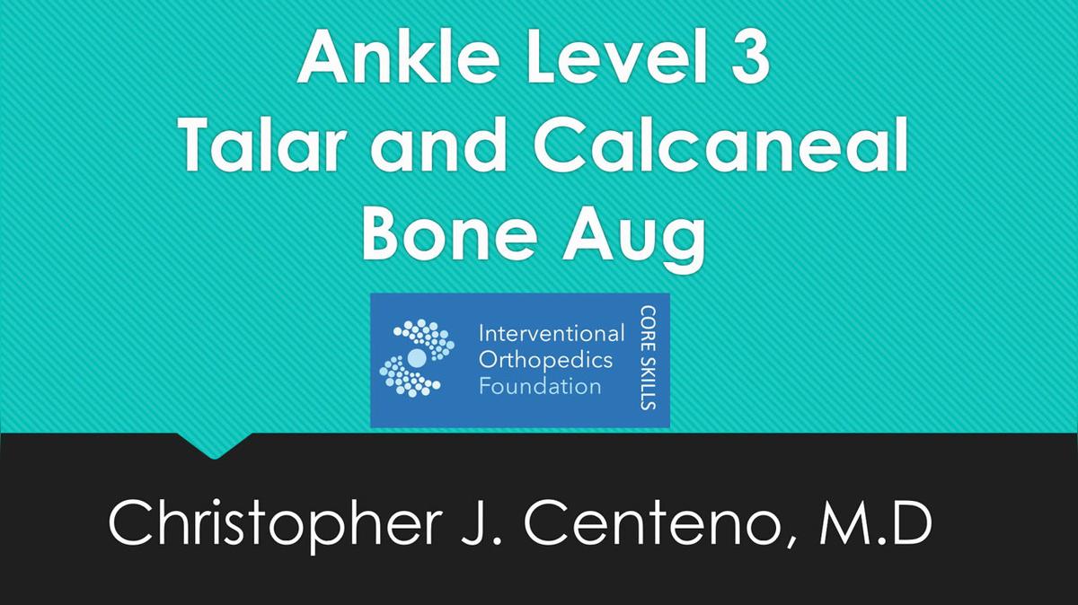 Intraosseous injections of the Lower Extremity
