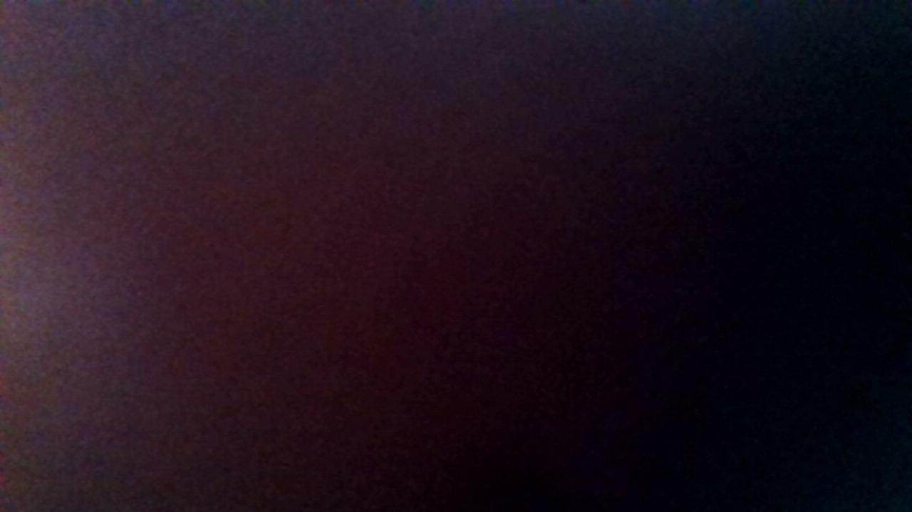 How was your post operative experience?