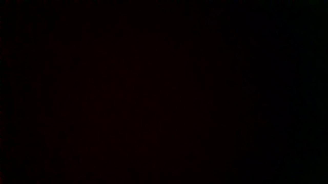 How was your post operative experience?