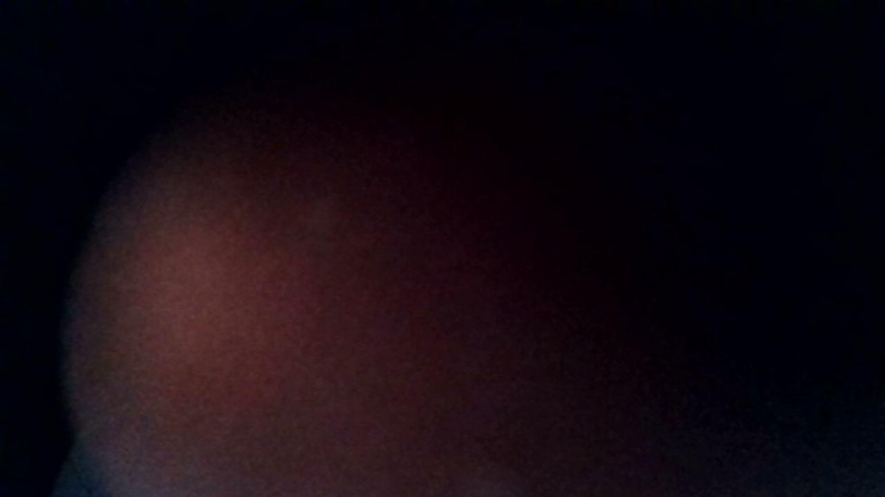 How was your post operative experience?