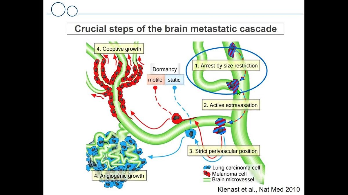 Brain metastases biology: from seed to soil, Frank
