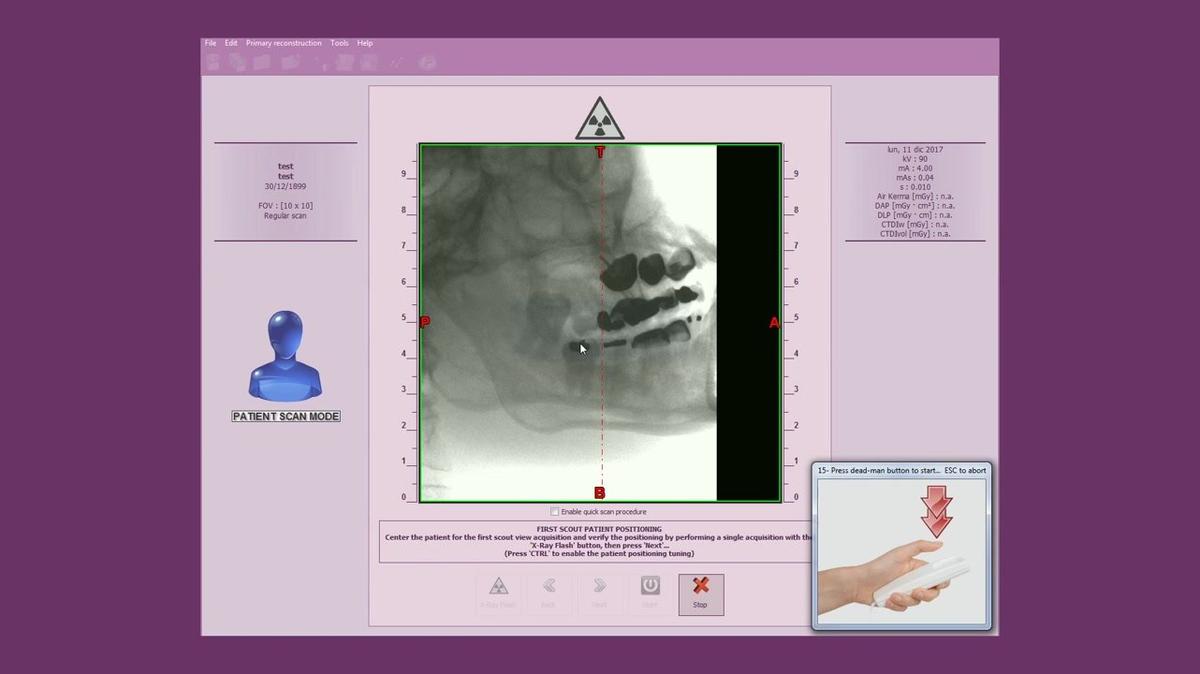 MyRay Hyperion X5 3D