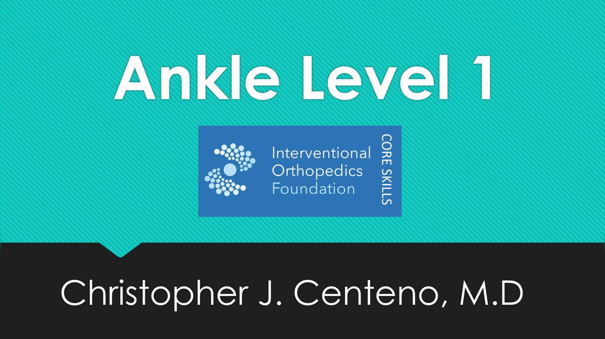 Ankle Level 1 TT Joint under US and Fluoro.mp4