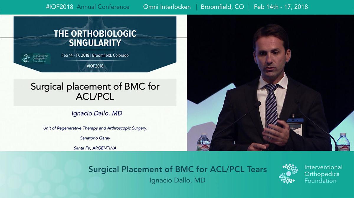 Surgical Placement of BMC for ACL PCL Tears (Dallo).mp4