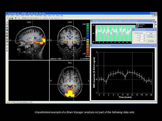 Kathy Mullen &quot;Fall Vision Meeting 2007: Color Processing in the Human LGN and Cortex measured with fMRI&quot;