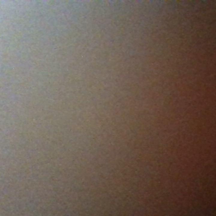 How was your post operative experience