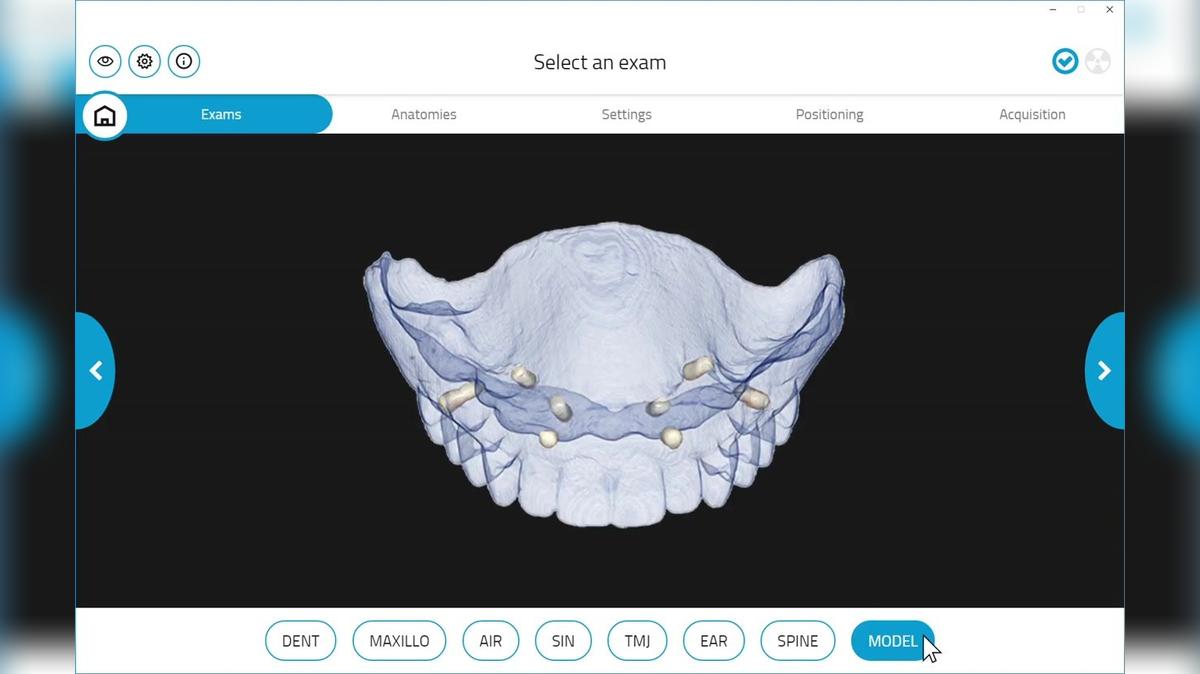 GiANO HR 3D Model/Denture Scan
