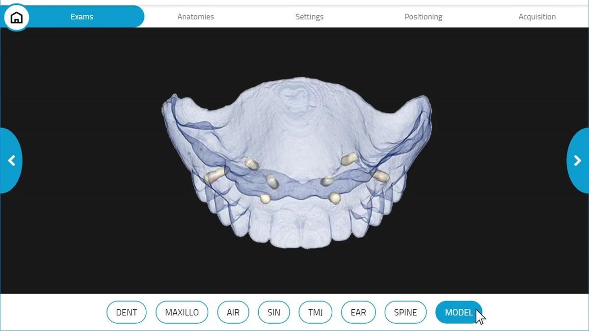 GiANO HR 3D Model/Denture Scan
