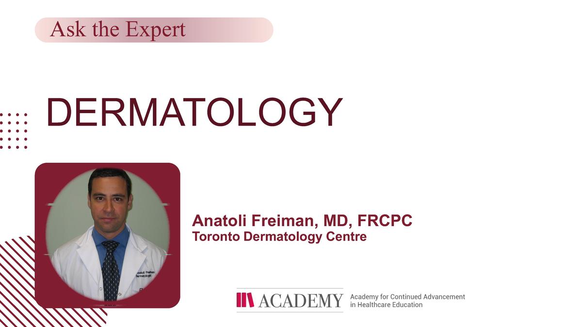 How Do You Manage Patients With Perioral Dermatitis?