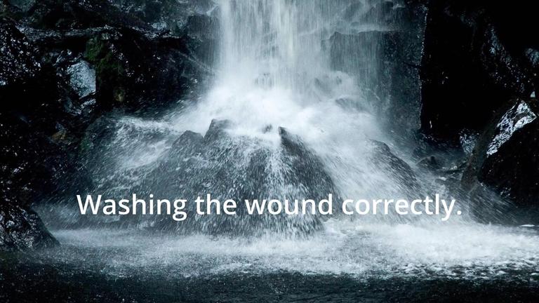 Washing the wound