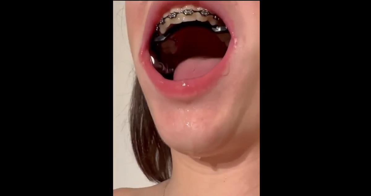 clampvid