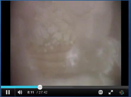 SP3 E48 Imperfect.mp4