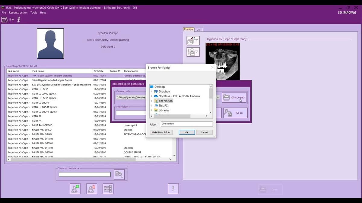 iRYS 11 - Exporting Data