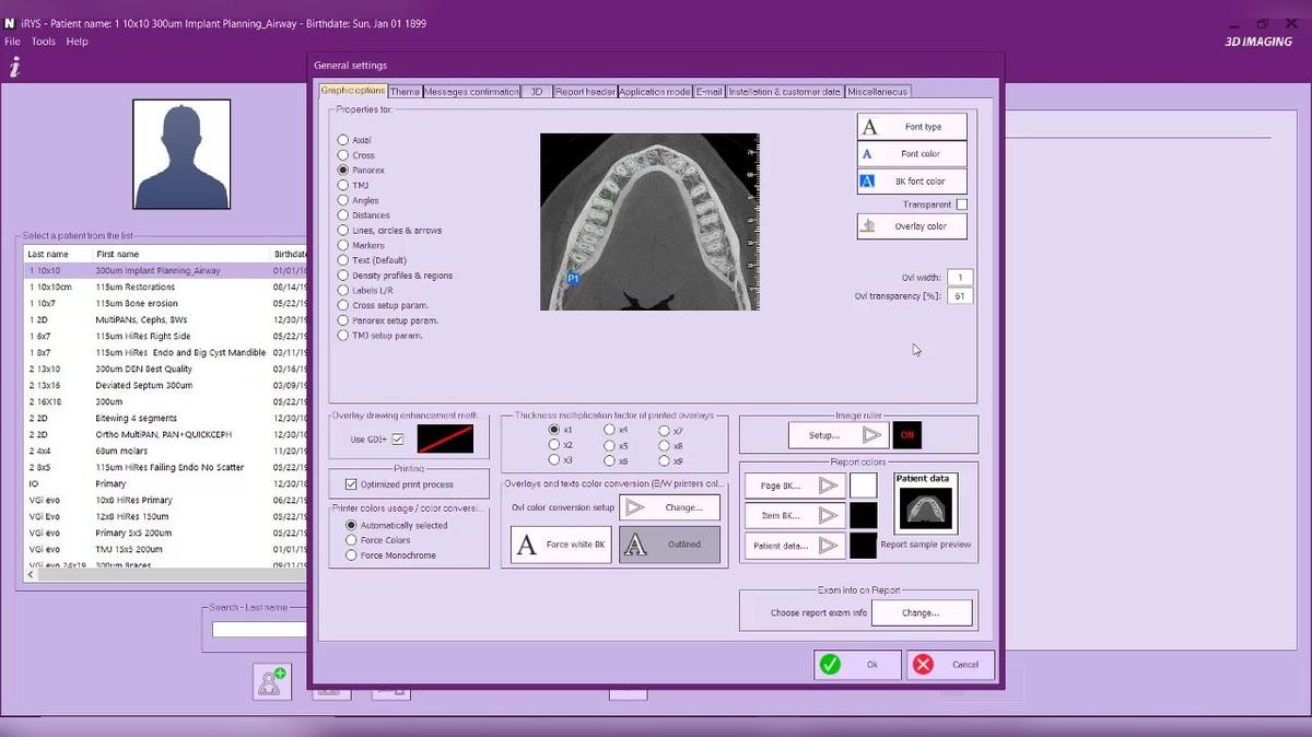 iRYS 11 - Graphic Options