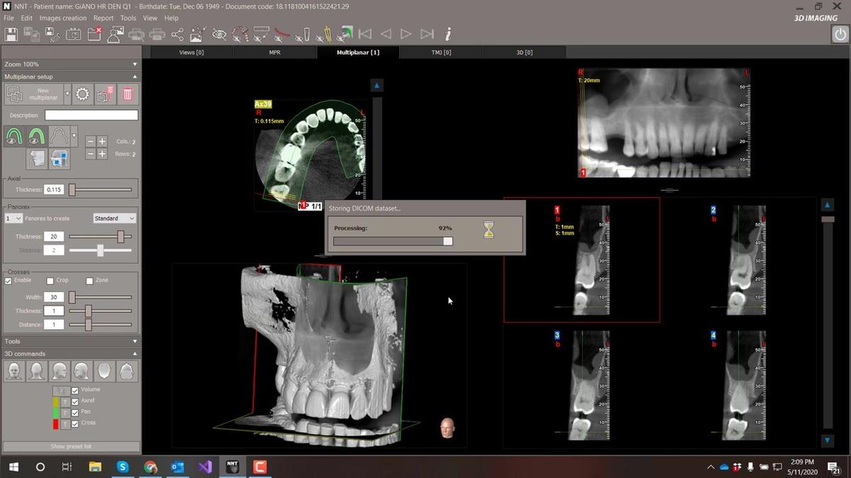 NNT 11 - Saving Data in DICOM Format