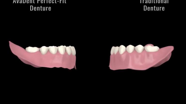 avadent_perfect_fit_dentures_small.mp4