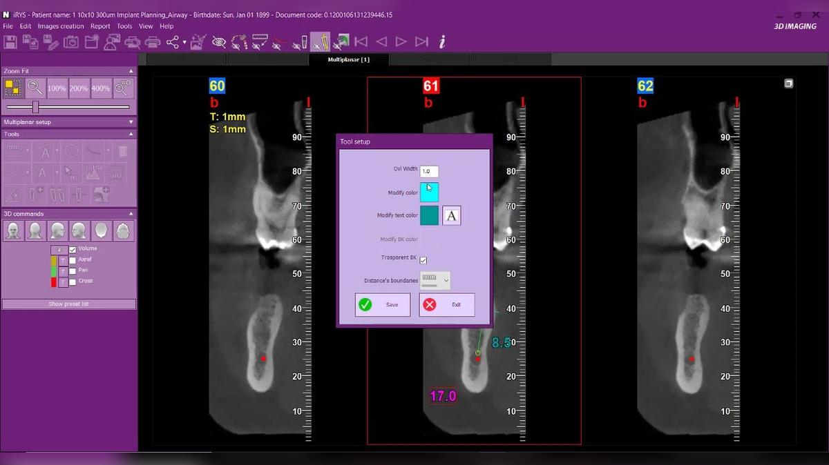 iRYS 11 -Distance Tool