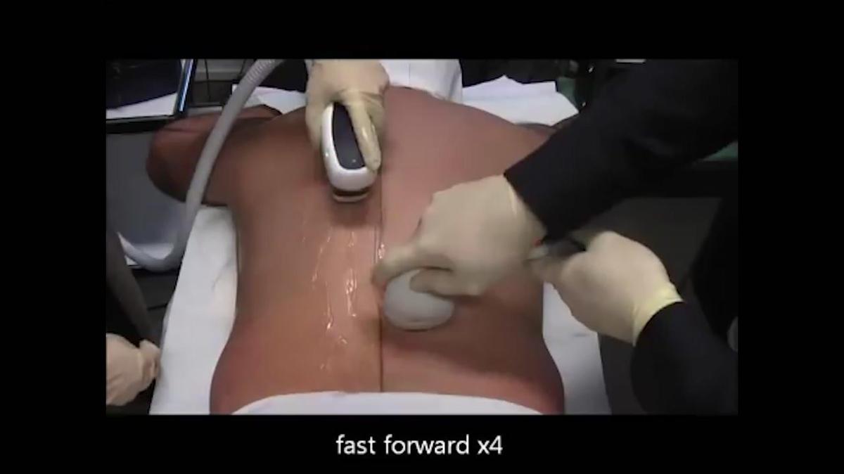 Hair Removal
