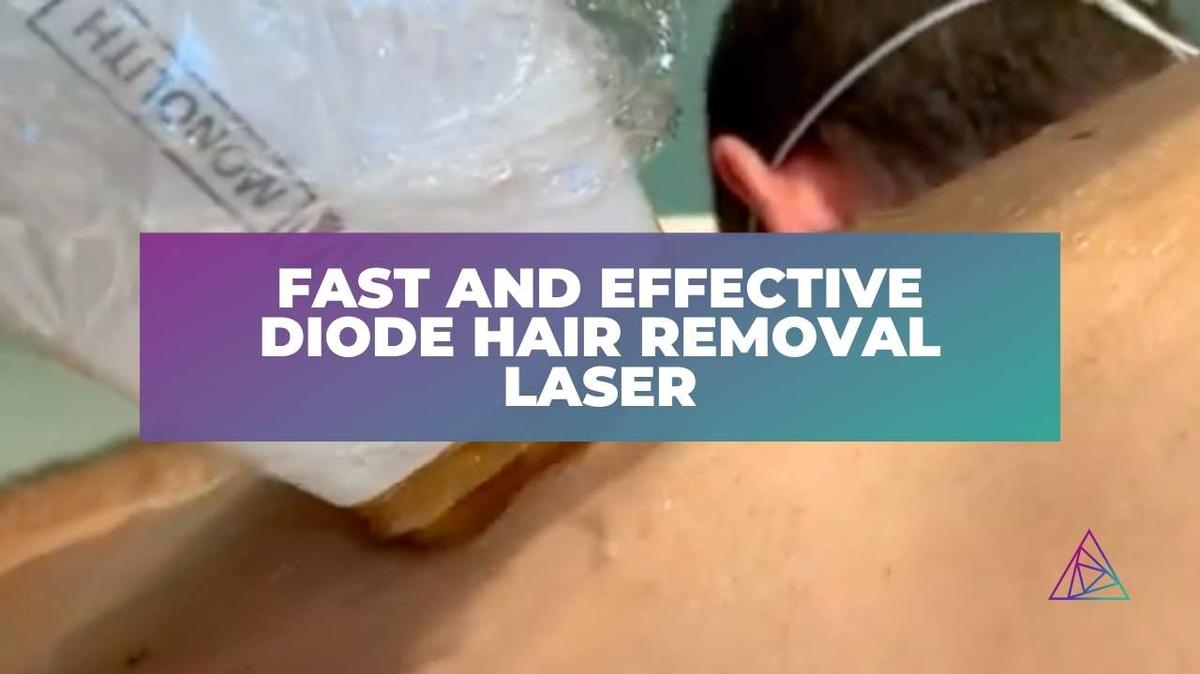 Fast and Effective Diode Hair Removal Laser