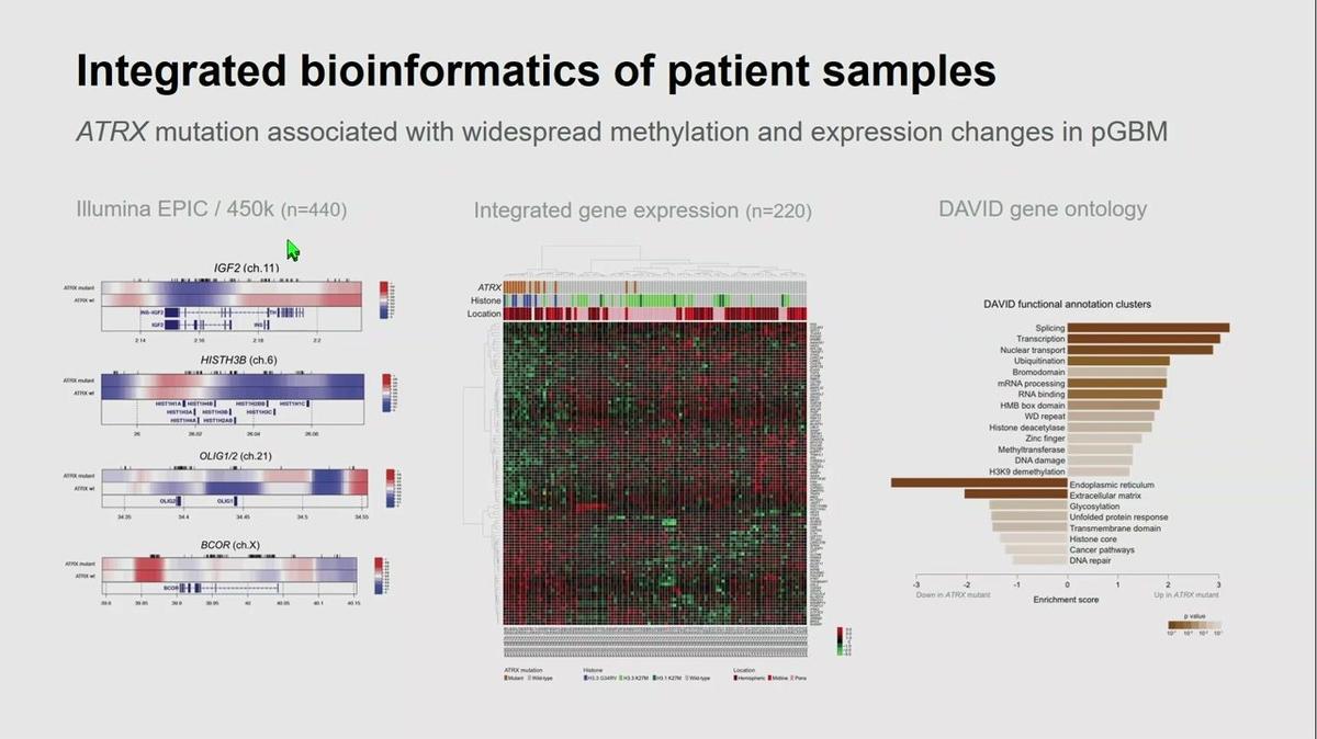 ATRX loss confers enhanced sensitivity to combined PARP inhibition and radiotherapy in pediatric glioblastoma models, Janat Fazal-Salom