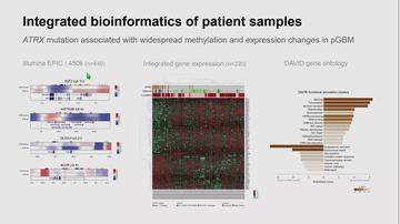 ATRX loss confers enhanced sensitivity to combined PARP inhibition and radiotherapy in pediatric glioblastoma models, Janat Fazal-Salom