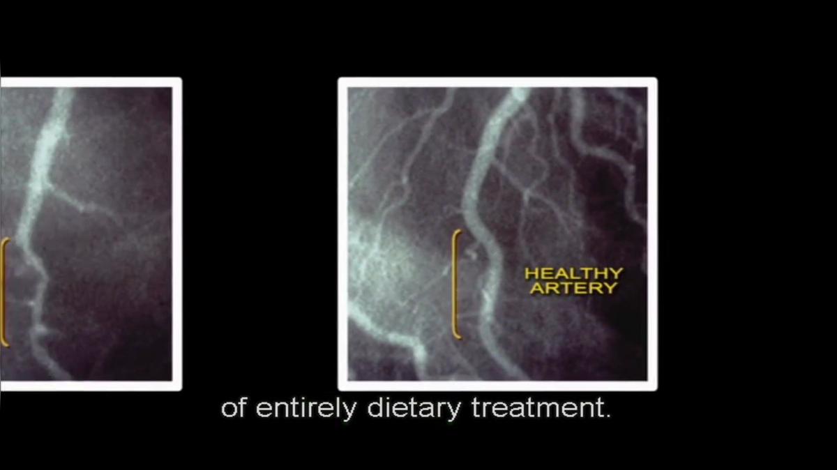 Forks over Knives Part 2.mp4