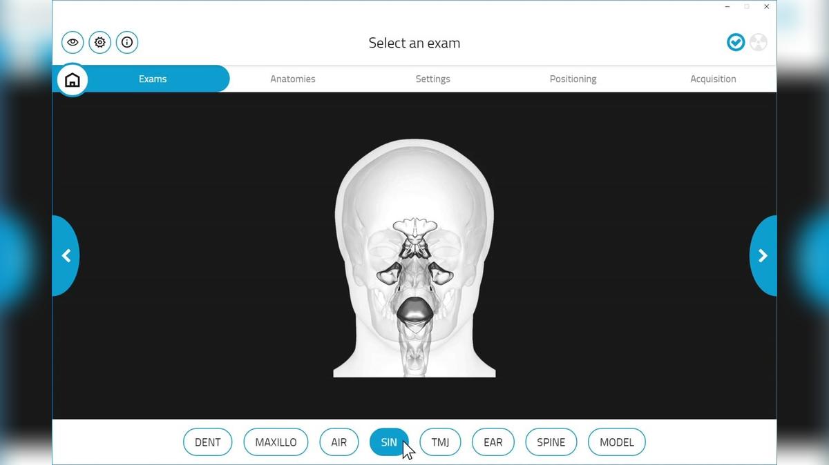 Giano HR 3D Maxillary Sinus Scan