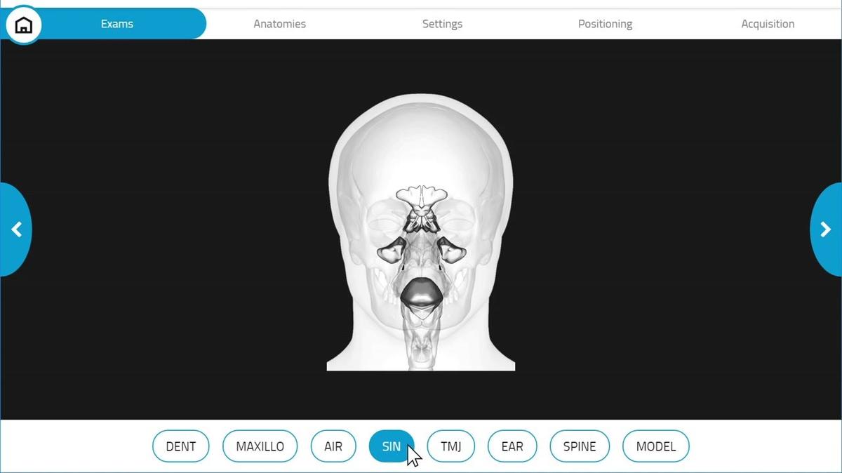 Giano HR 3D Maxillary Sinus Scan
