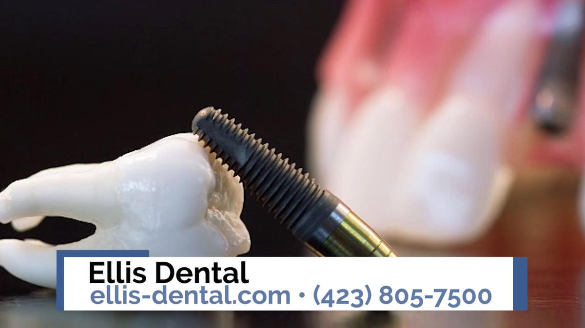 Restorative Dentist in Chattanooga TN, Ellis Dental